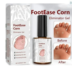 Delphi Space™ Footease Corn Remover Gel⭐️⭐️⭐️⭐️⭐️4.8/5 (7,600+ REVIEWS)