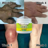 <p>Bee Venom Joint and Bone Therapy Cream</p> <p style="font-size: 15px; line-height: 1.5;">   Free Cash on Delivery 3 - 5 Days <br>   4k+ Sold last month <br> ⭐️⭐️⭐️⭐️⭐️4.8/5 (12,600+ REVIEWS)</p