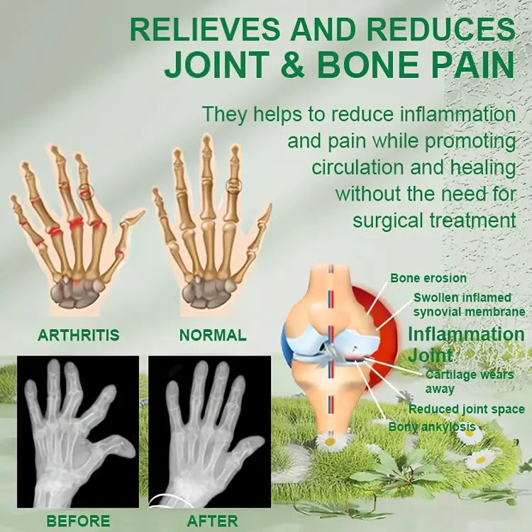 <p>Bee Venom Joint and Bone Therapy Cream</p> <p style="font-size: 15px; line-height: 1.5;">   Free Cash on Delivery 3 - 5 Days <br>   4k+ Sold last month <br> ⭐️⭐️⭐️⭐️⭐️4.8/5 (12,600+ REVIEWS)</p