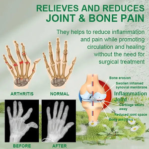 Bee Venom Joint and Bone Therapy Cream ⭐️⭐️⭐️⭐️⭐️4.8/5 (7,600+ REVIEWS)