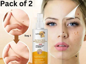 Medilisk™ Bee Venom Wart Remover Spray ⭐️⭐️⭐️⭐️⭐️4.8/5 (1600+ REVIEWS)