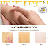 Bee Venom Psoriasis Treatment Cream 60gm (Pack Of 2)