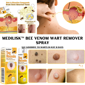 Medilisk™ Bee Venom Wart Remover Spray ⭐️⭐️⭐️⭐️⭐️4.8/5 (1600+ REVIEWS)