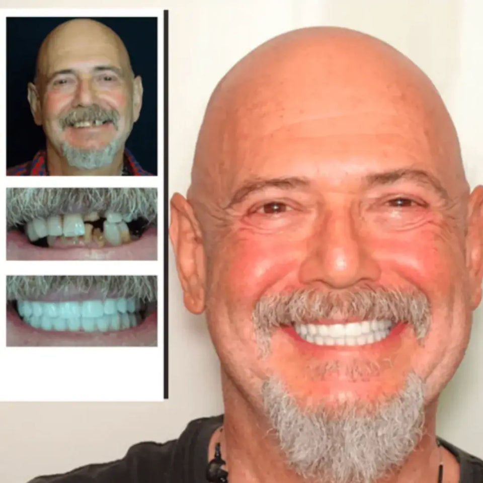 <p>Instant Adjustable Snap-in Teeth Denture </p> <p style="font-size: 15px; line-height: 1.5;">   Free Cash on Delivery 3 - 5 Days <br>   4k+ Sold last month <br> ⭐️⭐️⭐️⭐️⭐️4.8/5 (12,600+ REVIEWS)<br> Today Offer⏰ Buy 1 GET 1 FREE⏰ </p