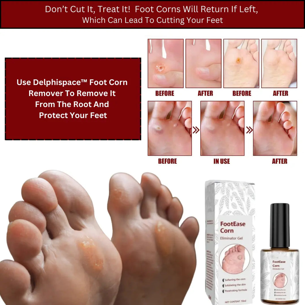 Delphi Space™ Footease Corn Remover Gel⭐️⭐️⭐️⭐️⭐️4.8/5 (7,600+ REVIEWS)